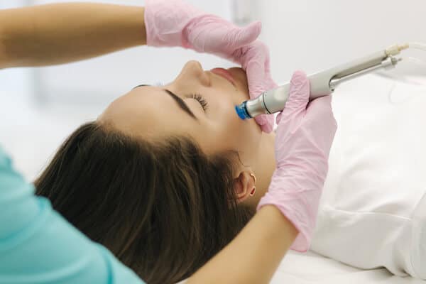 Extraction For Your Acne Prone Clogged Skin