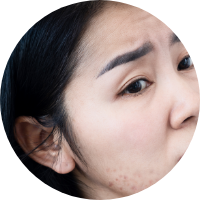 Combination Skin